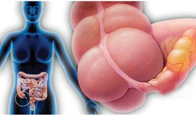 What Are The Signs Symptoms And Treatment Of Appendicitis