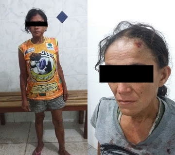 Em São Bernardo, Mulher agride a companheira a paulada e Chupa seu próprio sangue.