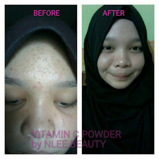 Image result for vit c powder nlee beauty