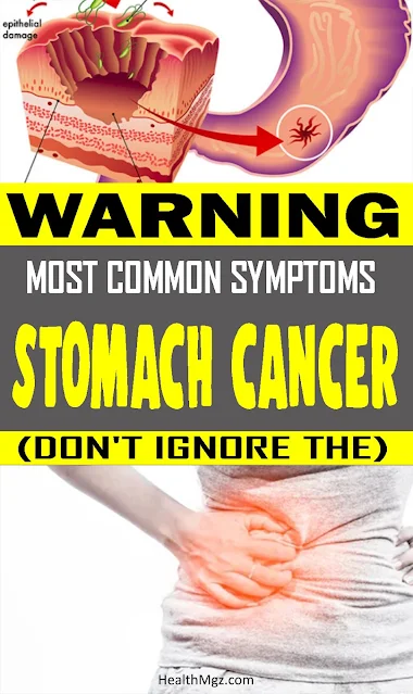 Stomach Cancer Is A Silent Killer! Here Are The Signs and Symptoms