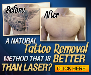  tca cream tattoo removal 