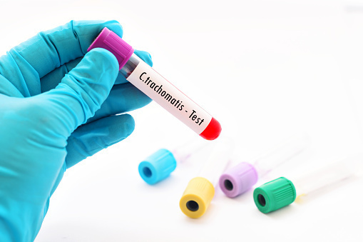 Chlamydia test