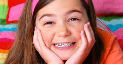 Lứa tuổi nào nên niềng răng chỉnh nha?