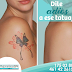 ¿Tienes un tatuaje del cuál te arrepientes? ¡Eliminalo con láser!, este tratamiento te permitirá ver cambios desde la primera sesión y en unas cuantas más verás cómo desaparece. Manda mensaje para más información http://bit.ly/2W54vPX ¡Te ofrecemos una Prueba gratis! Citas al 1750380 o por whats app 4614226155