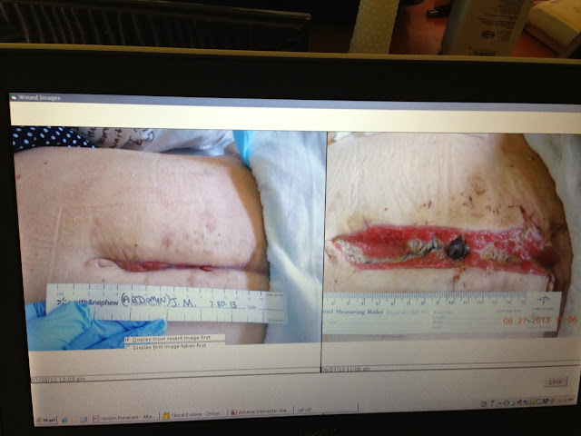 Moss Moments: belly wounds:: healing from the inside out.