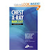 CHEST X RAY MADE EASY