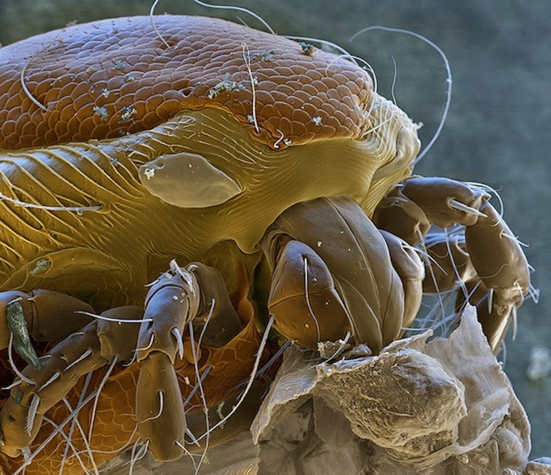 16 Terryfying Images From The Microscope - Water mite