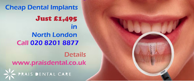 Low Cost Dental Implants In North London