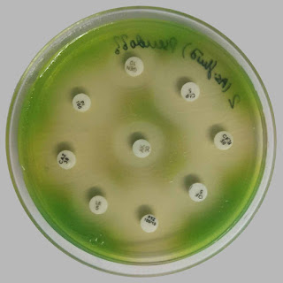 Antimicrobial Susceptibility Test