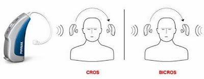  CROS hearing Aids
