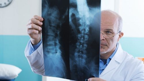 mesothelioma personal injury lawyers