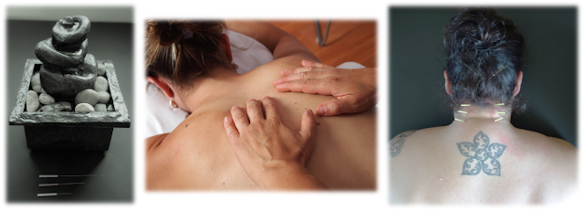 Dry Needling, Manual Therapy, Massage, Trigger Point Release, Physical Therapy