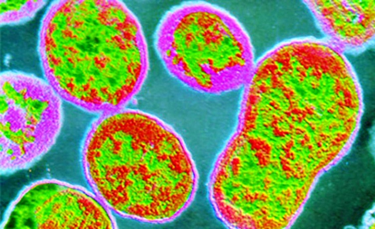 Infeksi Bakteri Brucella Menyerang China, Ini Gejala yang Perlu Kita Kenali