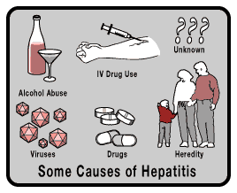 Cara Mengobati Hepatitis Secara Alami