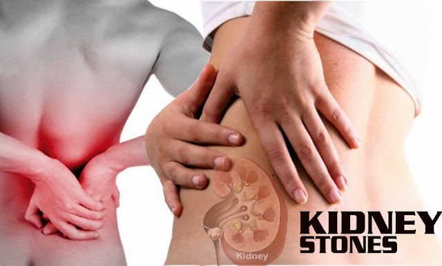 http://www.urologistindia.com/urinary-stones/