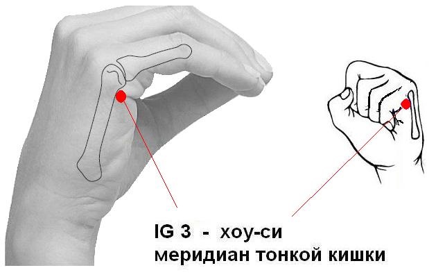 Точка ужасно. Точка ig3 Хоу-си. Ig3 точка акупунктуры. Хоу-си точка акупунктуры. Точка Хоу си расположение.