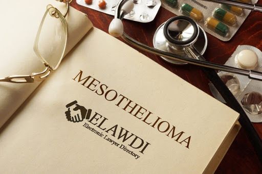 Image Mesothelioma Compensation