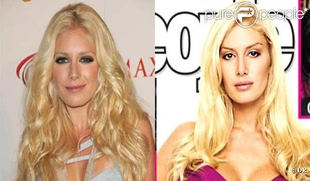 heidi montag before and after 2