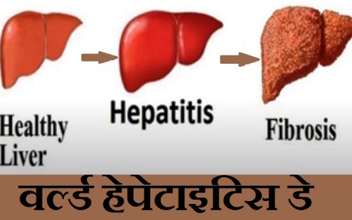 world hepatits day 2021 kab hai