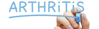 Arthritis Definition, Arthritis Symptoms, Causes