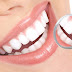 Tẩy trắng răng cho hàm răng trắng đẹp