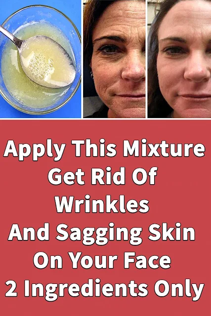 Wrinkles Around the Eyes? – Try This 2-Ingredient Homemade Remedy!