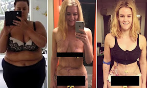 LUAR BIASA!! Gadis 168 Kg Ini Berhasil Membuang Separuh Berat Tubuhnya, Usaha Dietnya Menjadi Inspirasi Banyak Orang