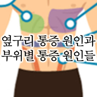 옆구리 통증에 대해서