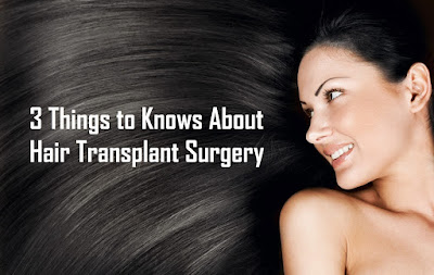 3 Things to Knows About Hair Transplant Surgery