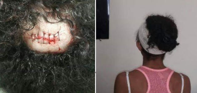 Rio Verde: Mulher é atingida com pedra ao passar perto de ex