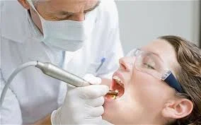 Khi nào cần chữa tủy răng ?