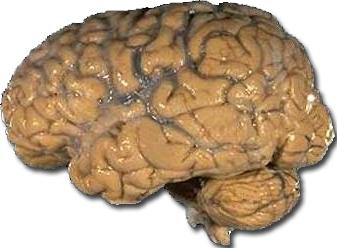 Imagen del Cerebro del hombre (Vista lateral)