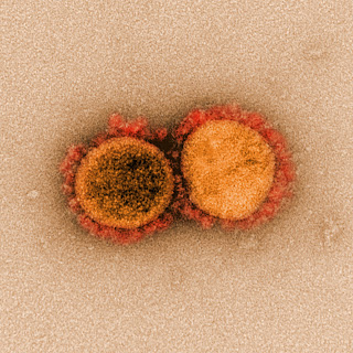 Microscopic image of two SARS-CoV-2 virus particles. They are both round with spikes all around the outer edge of the cell.