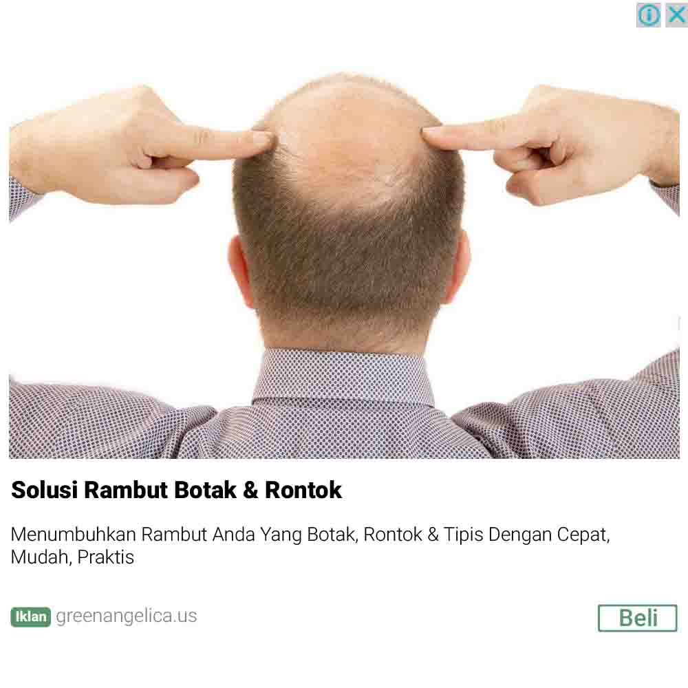 Dokter Rambut Hasil Penelusuran Untuk Harga Minyak Firdaus Di