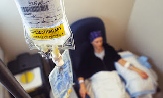Pengobatan Alternatif Kemoterapi