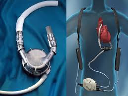 Cardiac Assist Devices Market