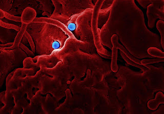  Viral microorganisms are parasites that infect cells of biological organisms ✔ Explanation About Viruses