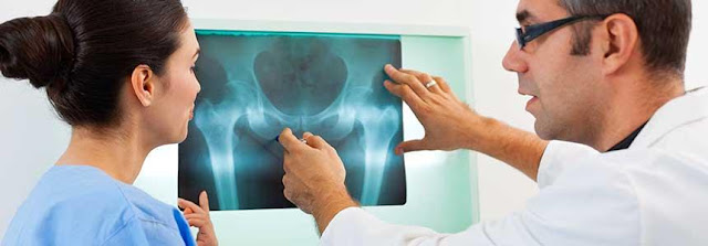 Best Hip Replacement Surgeons in India