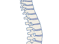 CAUSES OF LOW BACK PAIN.