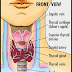 Penyakit Tiroid Dan Rawatan