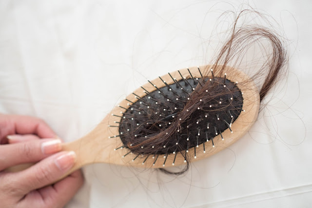 5 Postpartum Hair Loss Treatments & Remedies