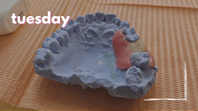 Tuesday - Denture Mold