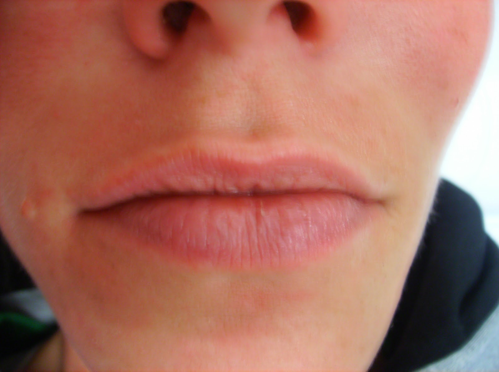 Permanent lip liner before and after