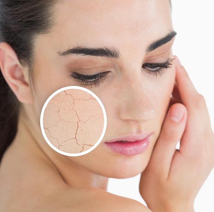 7 Dry Skin Care Tips in Marathi | कोरड्या त्वचेसाठी घरगुती उपचार