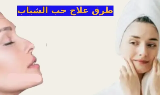 كيفية علاج حب الشباب والبقع السوداء من المنزل acne treatment