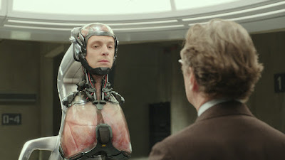Alex Murphy’s remaining body in RoboCop (2014) showing he has his head, lungs, and little else.