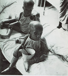 Foto Jutaan Anak Tewas Kelaparan Karena Perang Biafra [ www.BlogApaAja.com ]