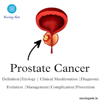 prostate cancer definition, biology, clinical diagnosis, evaluation, management, and treatment.