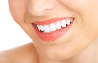 Cara+Memutihkan+Gigi+Secara+Alami Cara Ampuh Dan Sehat Memutihkan Gigi