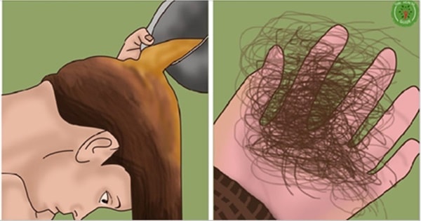como parar a queda de cabelo 